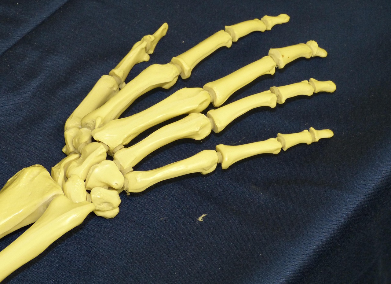 kiné arthrose